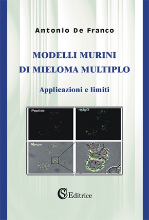 Modelli murini di mieloma multiplo.